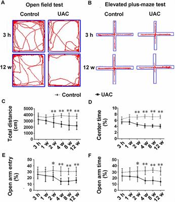 Malocclusion Generates Anxiety-Like Behavior Through a Putative Lateral Habenula–Mesencephalic Trigeminal Nucleus Pathway